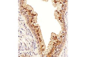 Immunohistochemical analysis of paraffin-embedded H. (IDH1 antibody  (AA 116-143))