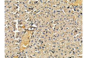 ABIN7095442 and ABIN7099499 at 1/100 staining mouse liver tissue by IHC-P.