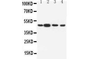 Anti-Dopamine Receptor D3 antibody, Western blotting Lane 1: Rat Testis Tissue Lysate Lane 2: Rat Brain Tissue Lysate Lane 3: U87 Cell Lysate Lane 4: HELA Cell Lysate (DRD3 antibody  (C-Term))