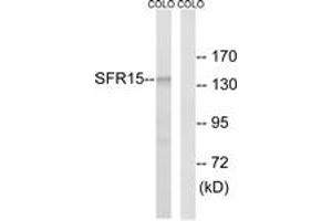 Western blot analysis of extracts from COLO cells, using SFRS15 Antibody. (SCAF4 antibody  (AA 601-650))