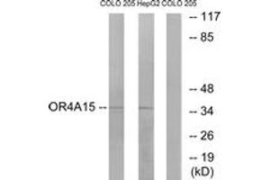 Western Blotting (WB) image for anti-Olfactory Receptor, Family 4, Subfamily A, Member 15 (OR4A15) (AA 261-310) antibody (ABIN2890996) (OR4A15 antibody  (AA 261-310))