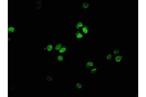 Immunofluorescence staining of HepG2 cells with ABIN7153076 at 1:66, counter-stained with DAPI.