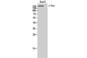 Western Blotting (WB) image for anti-Colony Stimulating Factor 1 Receptor (CSF1R) (Ser275) antibody (ABIN3174363) (CSF1R antibody  (Ser275))