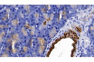 Immunohistochemistry (IHC) image for anti-Keratin 18 (KRT18) (AA 72-380) antibody (ABIN7433291)