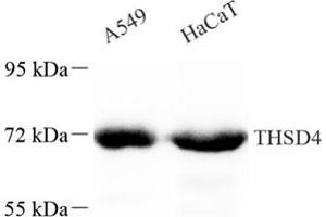 Western blot analysis of THSD4 (ABIN7075894),at dilution of 1: 200 (Thrombospondin, Type I, Domain Containing 4 (THSD4) antibody)