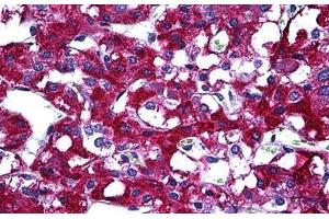 Human Adrenal: Formalin-Fixed, Paraffin-Embedded (FFPE) (PIM1 antibody  (AA 1-100))