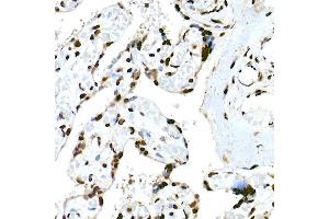 Immunohistochemistry of paraffin-embedded human placenta using RBM3 Rabbit mAb (ABIN7270084) at dilution of 1:25 (40x lens). (RBM3 antibody)