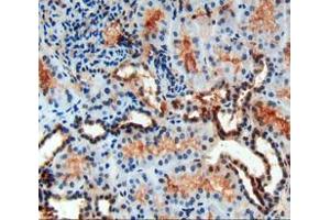 IHC-P analysis of kidney tissue, with DAB staining. (PDGF-BB Homodimer (AA 82-190) antibody)