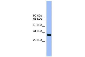 WB Suggested Anti-C1orf216 Antibody Titration: 0. (C1ORF216 antibody  (N-Term))