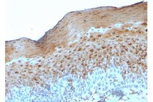 Formalin-fixed, paraffin-embedded human Tonsil stained with Involucrin Mouse Monoclonal Antibody (SY5). (Involucrin antibody)