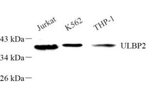 Western blot analysis of ULBP256 (ABIN7076145) at dilution of 1: 500 (ULBP2 antibody)
