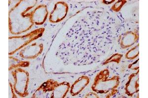 IHC image of  diluted at 1:100 and staining in paraffin-embedded human kidney tissue performed on a Leica BondTM system. (Recombinant GSK3 beta antibody  (pSer9))