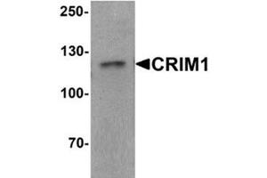 Western blot analysis of CRIM1 in Jurkat cell lysate with CRIM1 Antibody  at 1 ug/ml. (CRIM1 antibody  (C-Term))