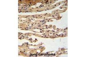 Immunohistochemistry (IHC) image for anti-FK506 Binding Protein Like (FKBPL) antibody (ABIN3002248) (FKBPL antibody)