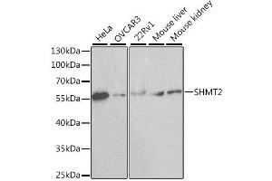 Western blot analysis of extracts of various cell lines, using SHMT2 antibody. (SHMT2 antibody  (AA 265-504))