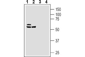 Western blot analysis of human LNCaP prostate carcinoma cell line lysates (lanes 1 and 3) and human  monocytic leukemia cell line lysates (lanes 2 and 4):1-2. (Solute Carrier Family 39 (Zinc Transporter), Member 14 (SLC39A14) Peptide)