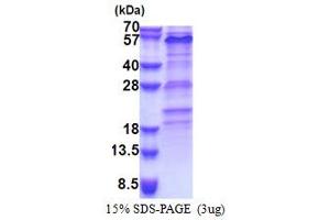 SDS-PAGE (SDS) image for Zinc Finger Protein 689 (ZNF689) (AA 1-500) protein (His tag) (ABIN5853320) (ZNF689 Protein (AA 1-500) (His tag))