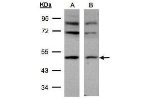 WB Image Sample(30 μg of whole cell lysate) A:293T B:HeLa S3, 10% SDS PAGE antibody diluted at 1:500