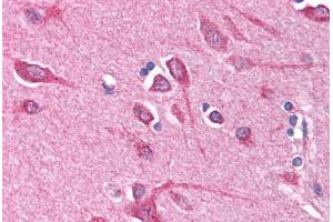 Human Brain, Cortex (formalin-fixed, paraffin-embedded) stained with BCL10 antibody ABIN214584 at 5 ug/ml followed by biotinylated goat anti-rabbit IgG secondary antibody ABIN481713, alkaline phosphatase-streptavidin and chromogen. (BCL10 antibody  (N-Term))