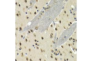 Immunohistochemistry of paraffin-embedded mouse brain using MAX antibody (ABIN5971184) at dilution of 1/200 (40x lens). (MAX antibody)