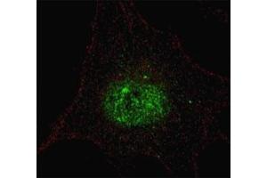Fluorescent confocal image of SY5Y cells stained with phospho-PDX1 antibody.