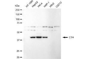 Western blotting analysis using CTH antibody (ABIN7798233).