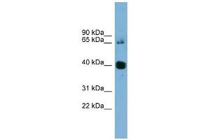 NODAL antibody used at 1 ug/ml to detect target protein. (Nodal antibody)