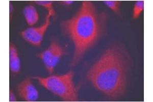 Image no. 3 for anti-Adducin 1 (Alpha) (ADD1) (pSer726) antibody (ABIN196918) (alpha Adducin antibody  (pSer726))