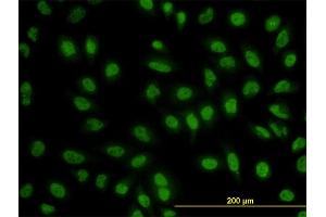 Immunofluorescence of monoclonal antibody to BCL9 on HeLa cell. (BCL9 antibody  (AA 1036-1135))