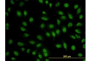 Immunofluorescence of monoclonal antibody to BCL9 on HeLa cell. (BCL9 antibody  (AA 1036-1135))