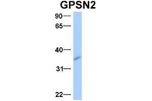 Host:  Rabbit  Target Name:  GPSN2  Sample Type:  Human Fetal Brain  Antibody Dilution:  1. (TECR antibody  (Middle Region))