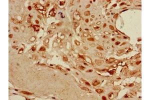 Immunohistochemistry of paraffin-embedded human placenta tissue using ABIN7149878 at dilution of 1:100 (DKK1 antibody  (AA 33-266))