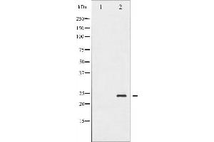 Western blot analysis of BAD phosphorylation expression in Forskolin treated 293 whole cell lysates,The lane on the left is treated with the antigen-specific peptide.