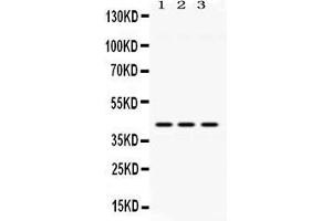 Western blot analysis of ACAA2 expression in rat lung extract ( Lane 1), mouse brain extract ( Lane 2) and HELA whole cell lysates ( Lane 3). (ACAA2 antibody  (Middle Region))