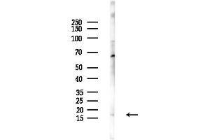 anti-NADH Dehydrogenase (Ubiquinone) 1 alpha Subcomplex, 13 (NDUFA13) (N-Term) antibody