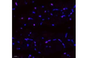 Immunofluorescence of paraffin embedded mouse skeletal muscle using SIX1 (ABIN7075617) at dilution of 1: 650 (400x lens) (SIX Homeobox 1 antibody)
