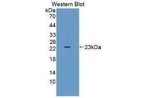 Detection of Recombinant UACA, Human using Polyclonal Antibody to Uveal Autoantigen With Coiled Coil Domains And Ankyrin Repeats (UACA) (UACA antibody  (AA 29-209))