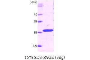 SDS-PAGE (SDS) image for Tumor Necrosis Factor (Ligand) Superfamily, Member 10 (TNFSF10) (AA 114-281) protein (ABIN666704) (TRAIL Protein (AA 114-281))