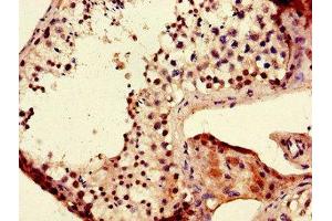 Immunohistochemistry of paraffin-embedded human testis tissue using ABIN7165750 at dilution of 1:100 (LIN28B antibody  (AA 166-250))