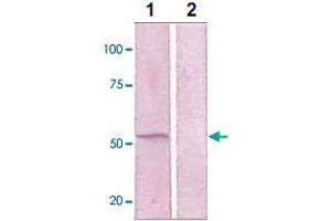 The whole cell lysates derived from EGF-stimulated A-431 were immunoblotted by MAP2K5 (phospho S311/T315) polyclonal antibody  at 1 : 1000 (Lane 1). (MAP2K5 antibody  (pSer311, pThr315))