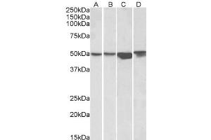 ABIN570904 (1µg/ml) staining of HEK293 (A), A431 (B), HeLa (C) and Jurkat (D) lysates (35µg protein in RIPA buffer). (ILK antibody  (C-Term))