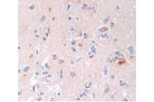 IHC-P analysis of Human Brain Tissue, with DAB staining. (BNP antibody)