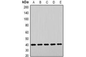 Western blot analysis of LHX6 expression in HepG2 (A), NIH3T3 (B), mouse brain (C), mouse liver (D), rat heart (E) whole cell lysates. (LHX6 antibody)