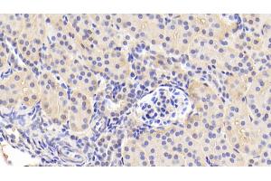 Detection of ANGPT1 in Human Kidney Tissue using Polyclonal Antibody to Angiopoietin 1 (ANGPT1) (Angiopoietin 1 antibody  (AA 284-452))