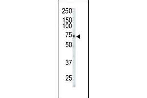 Western blot analysis of anti-EphA3 Pab (ABIN391888 and ABIN2841708) in CHO cell lysate. (EPH Receptor A3 antibody  (C-Term))