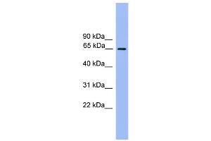 WB Suggested Anti-UBQLN2 Antibody Titration: 0. (Ubiquilin 2 antibody  (N-Term))