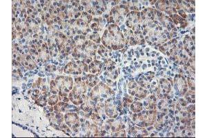 Immunohistochemical staining of paraffin-embedded Human pancreas tissue using anti-MTFMT mouse monoclonal antibody.