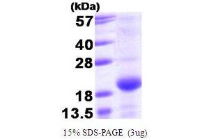 SDS-PAGE (SDS) image for Bcl2 Modifying Factor (BMF) (AA 1-129) protein (T7 tag) (ABIN666770)