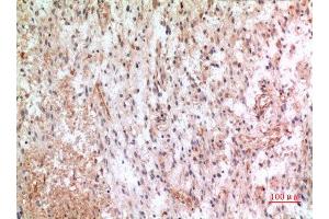 Immunohistochemistry (IHC) analysis of paraffin-embedded Human Brain, antibody was diluted at 1:100. (CX3CL1 antibody  (Internal Region))