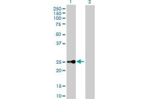 Western Blot analysis of CBX5 expression in transfected 293T cell line by CBX5 MaxPab polyclonal antibody. (CBX5 antibody  (AA 1-191))